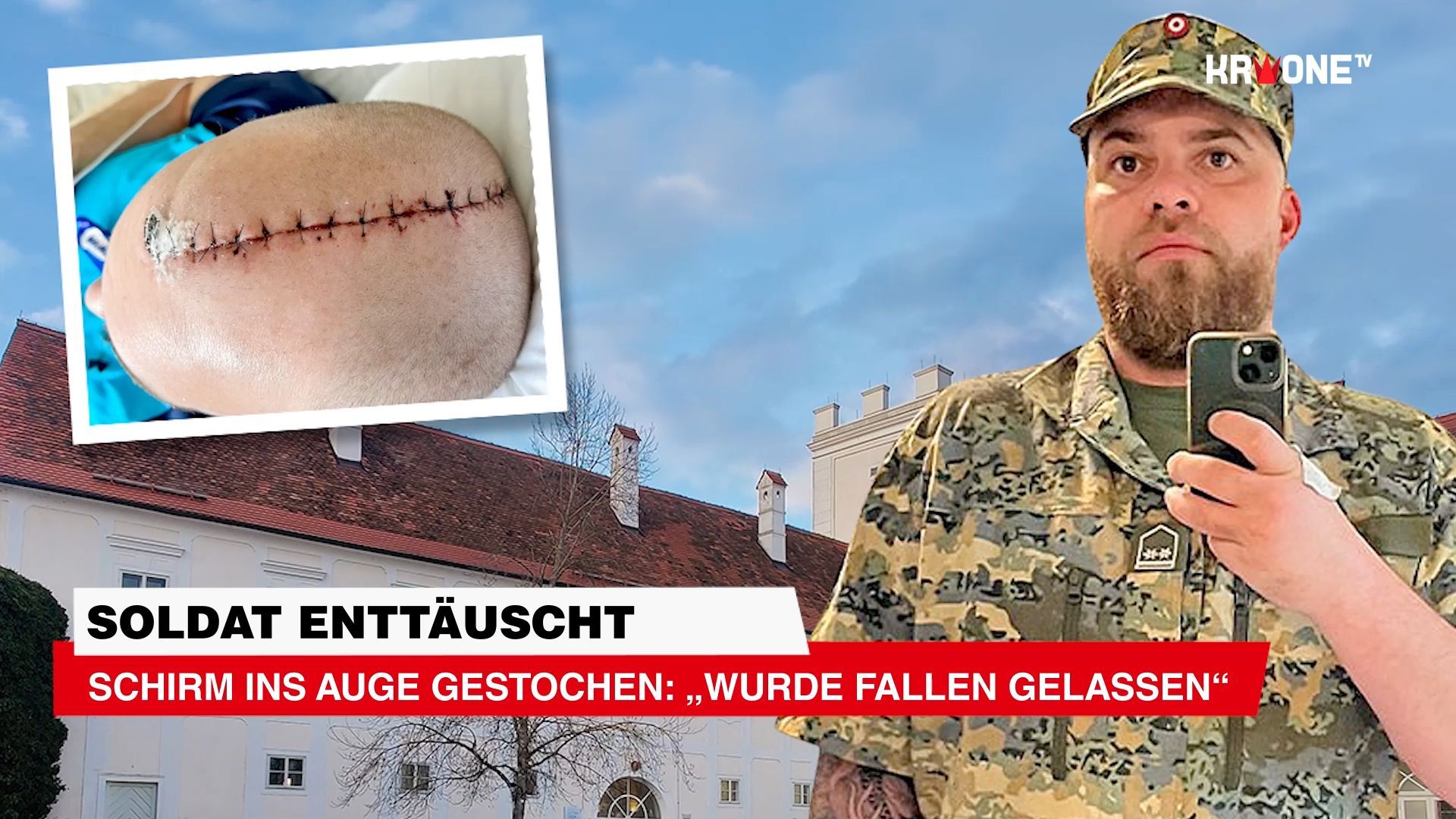 Video: Schirm ins Auge gestochen: „Wurde fallen gelassen“