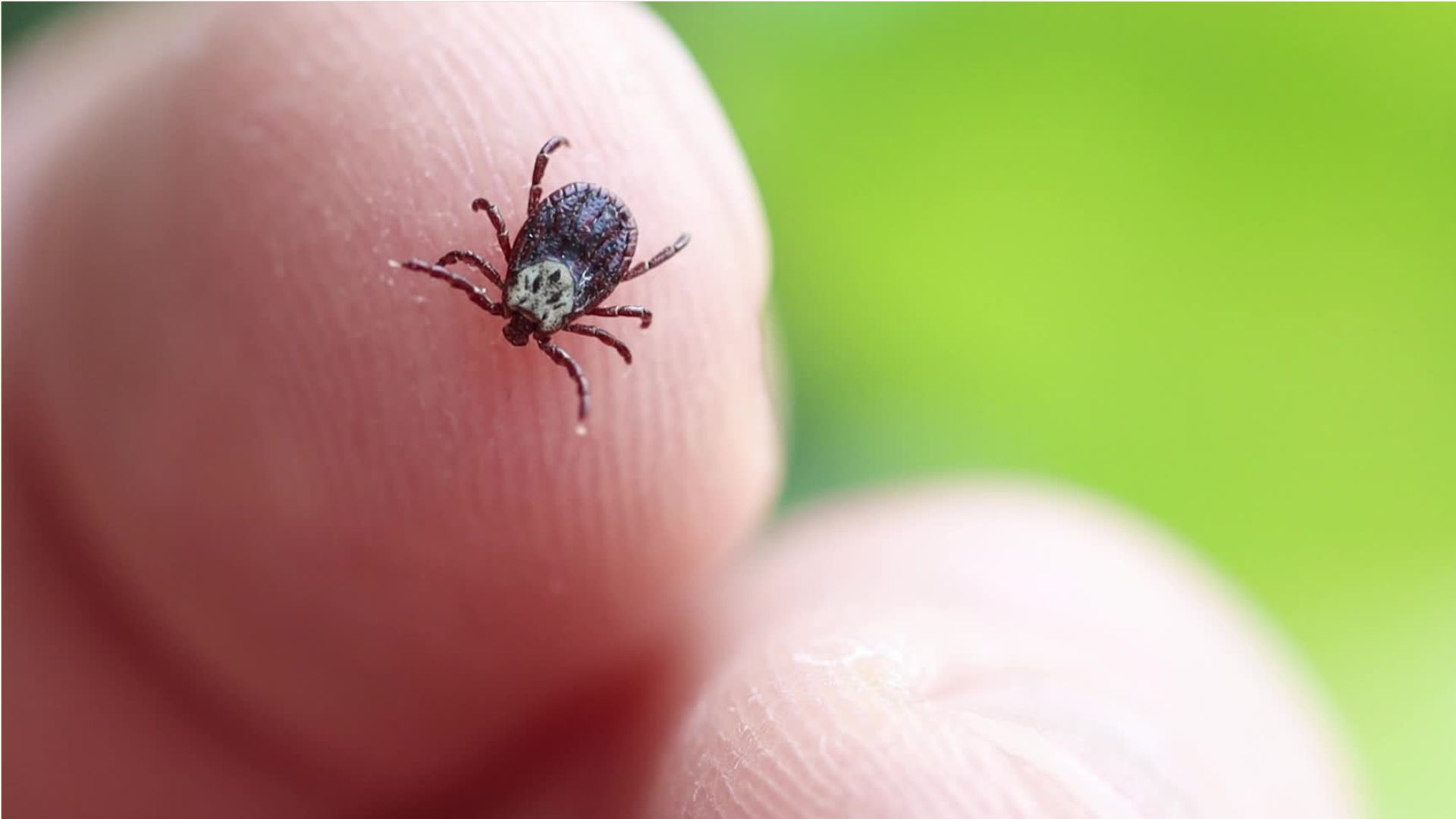 Zeckenstich mit Folgen? Das sind Anzeichen für Borreliose