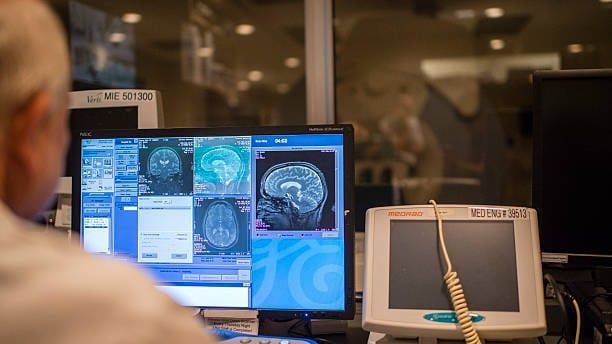 Video: Neuer Forschungsansatz könnte Gedächtnisverlust bei Alzheimer bremsen