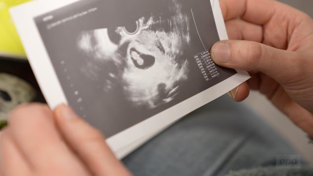 Pflichtberatung bei Abtreibungen: Hilfe oder Hindernis?
