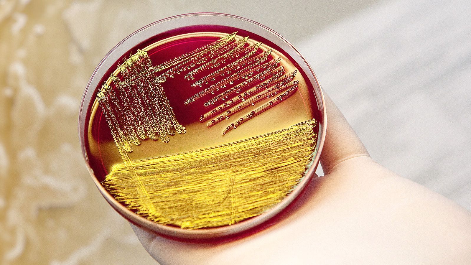 Video: Gefährliches EHEC-Darmvirus ist zurück