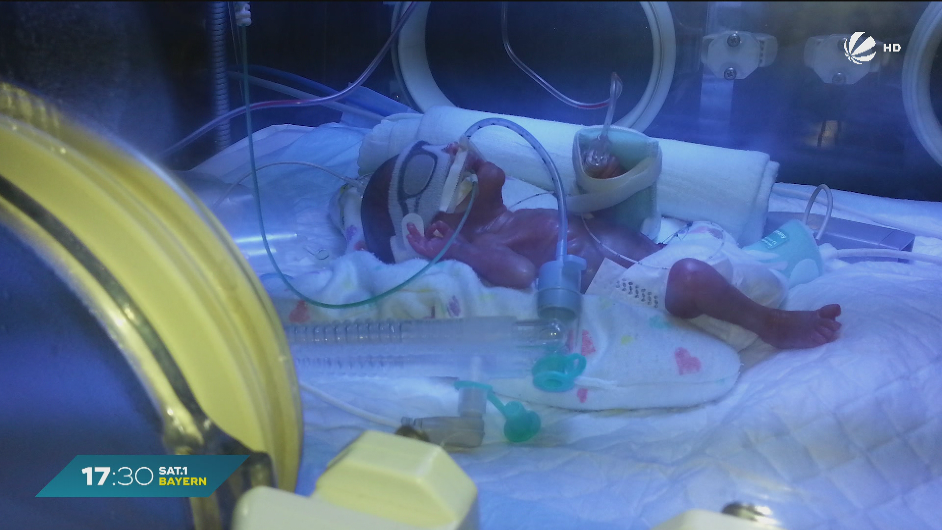 Video: Frühchen-Wunder Victoria aus Niederbayern: Von 320 Gramm zum gesunden Schulkind