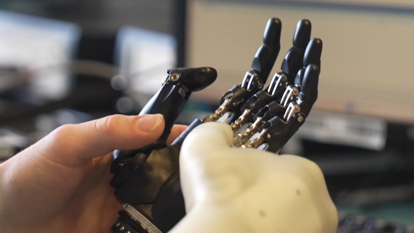 Video: Leben mit Hightech-Hände